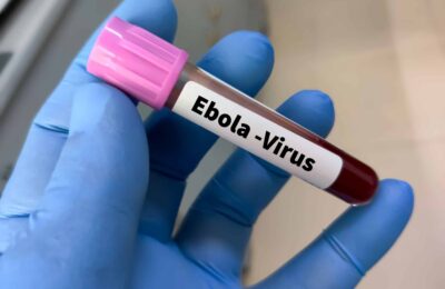 Ebola