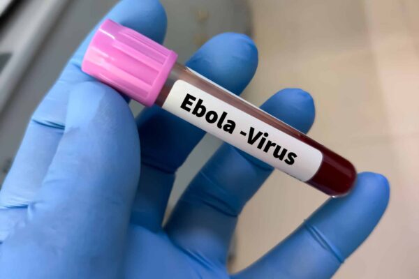 Ebola