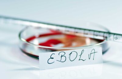 Ebola