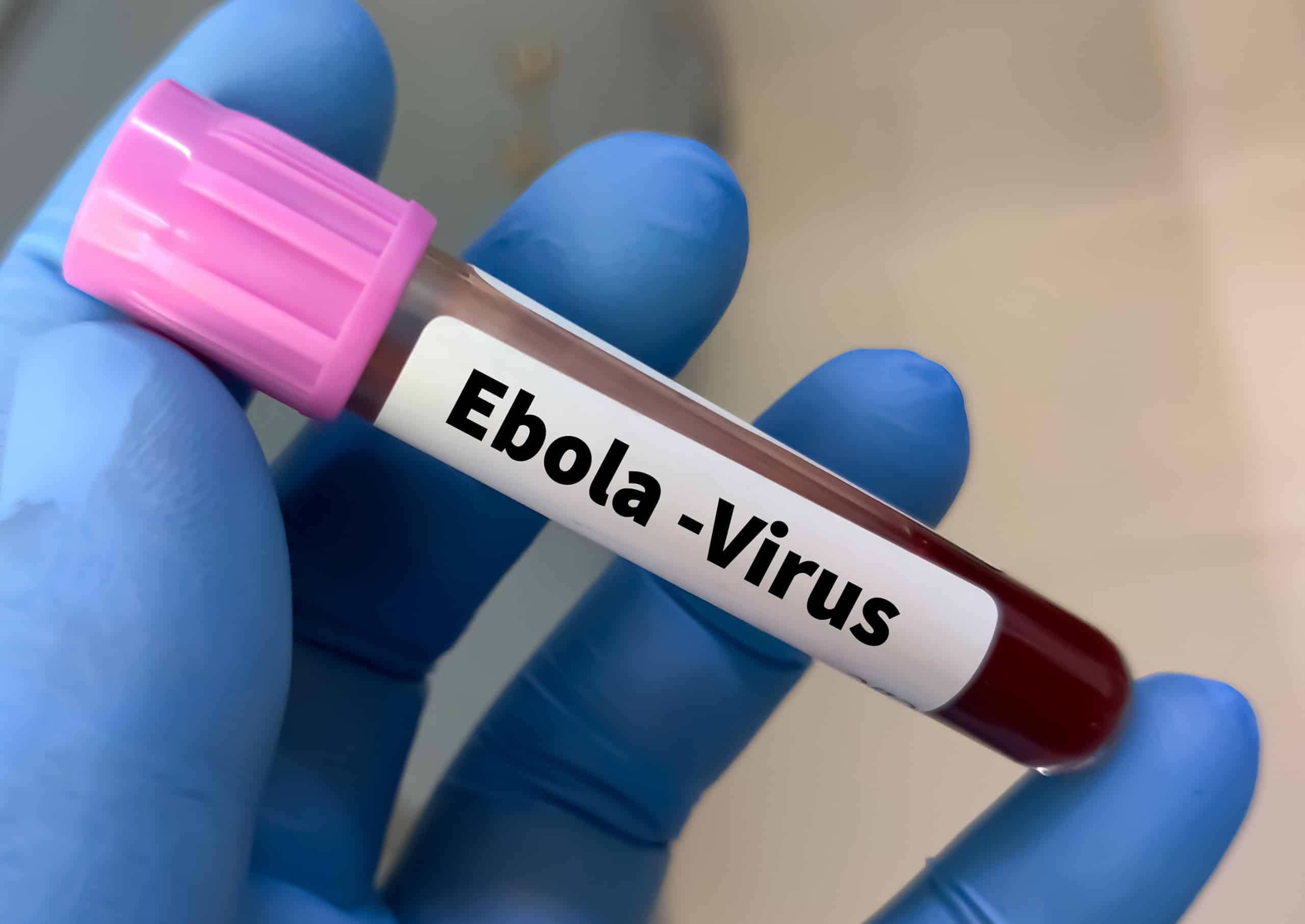 Ebola scaled 1