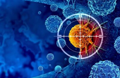 Celulas cancerigenas