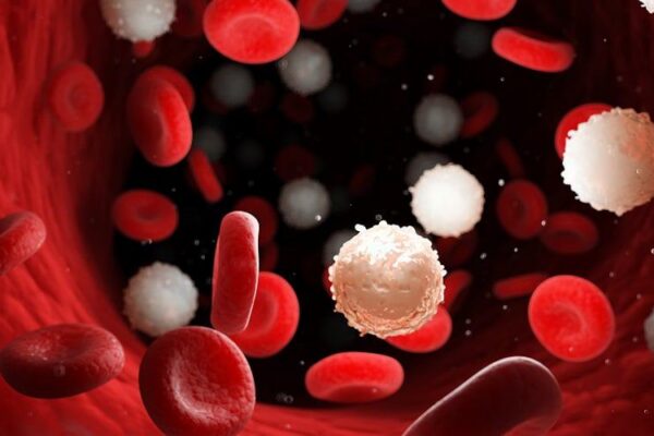 Leucemia